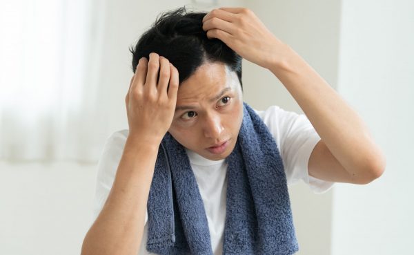 頭皮を気にする男性